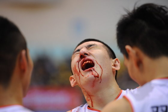 2025年1月9日葡聯(lián)杯半決賽本菲卡vs布拉加直播【24直播網(wǎng)】